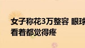 女子称花3万整容 眼球眼角被缝一起 网友：看着都觉得疼